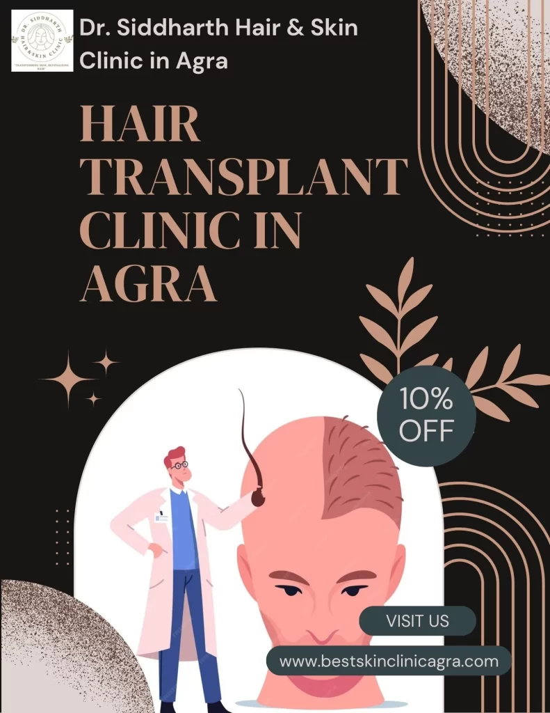Best Hair Transplant Clinic in Agra