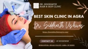 Read more about the article Best Skin Clinic in Agra for Complete Treatment of Skin and Hair