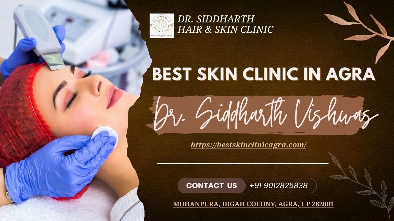 You are currently viewing Best Skin Clinic in Agra for Complete Treatment of Skin and Hair