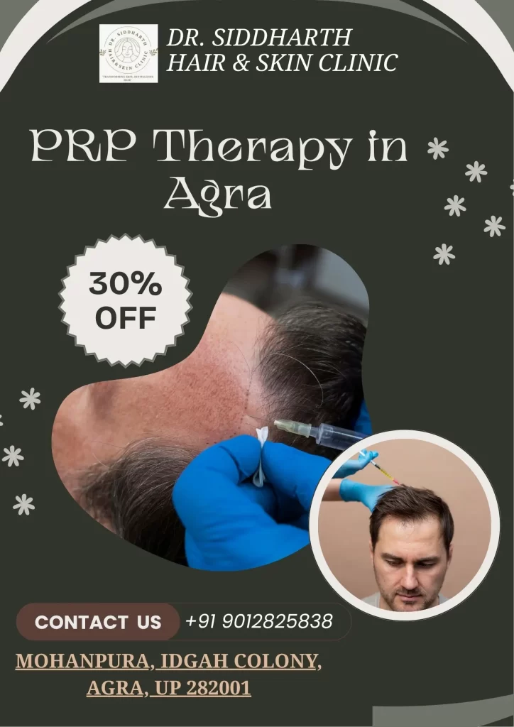 PRP Therapy in Agra